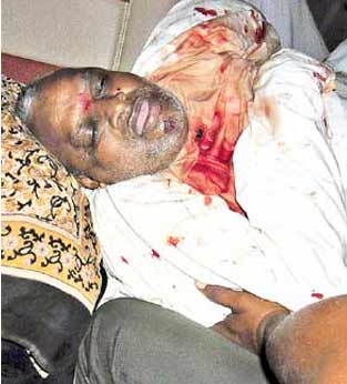 Yerram Naidu Dead, Yerram Naidu Death, Yerram Naidu died, Yerram Naidu dies, Yerram Naidu passed away, Yerram Naidu nomore